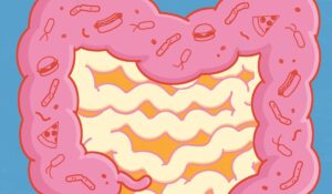 The Missing Link Between High-fat Diet, Gut Microbes and Heart Disease