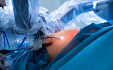 Robotic Procedure Creates Functional Ureter from Small Bowel