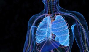 AI Refines Lung Cancer Screenings