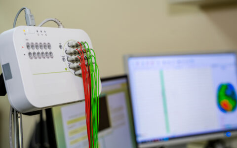 EEG Monitoring Reflects Delirium in Mechanically Ventilated Patients