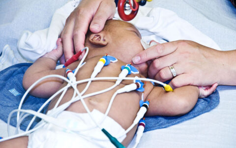 Nuanced View of Steroid Treatment Emerges in Large Infant Heart Study